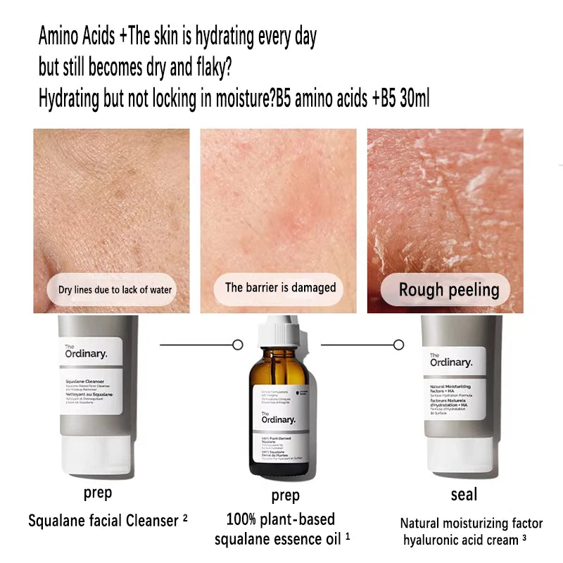 Esqualano 100% diseñado por plantas para la hidratación de la piel y el cabello Suero facial 30 ml puede prevenir la pérdida de factores de hidratación + HA 100 ml